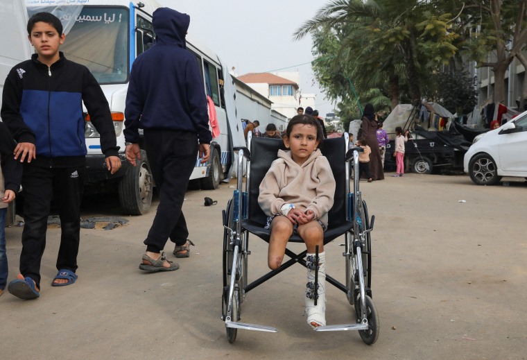 Surgeons report unprecedented numbers of limbs amputations among children in Gaza