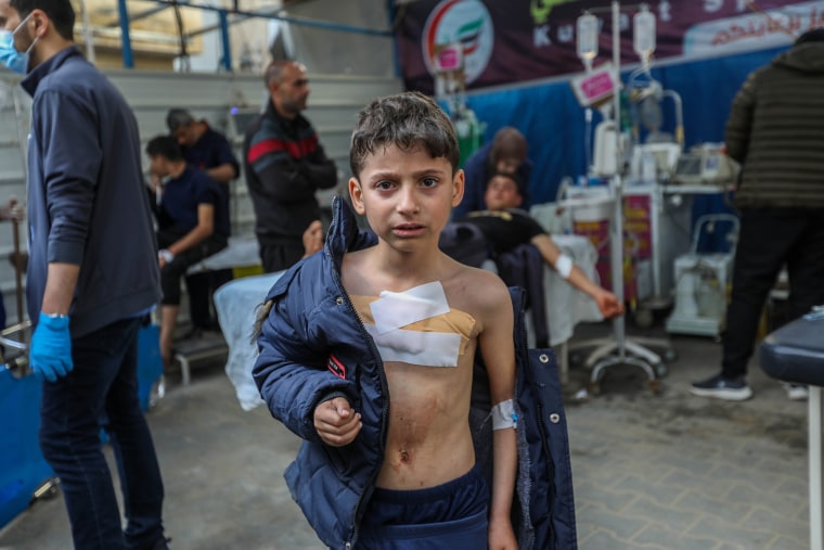 An injured young Palestinian is treated at Kuwait Hospital on Jan. 8, 2024 in Rafah, Gaza. 