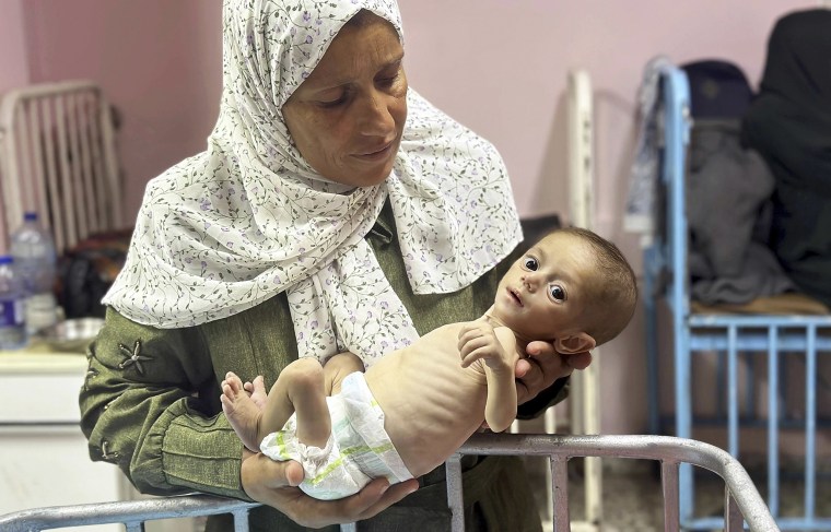 A grandmother cradles a malnourished six-month-old baby