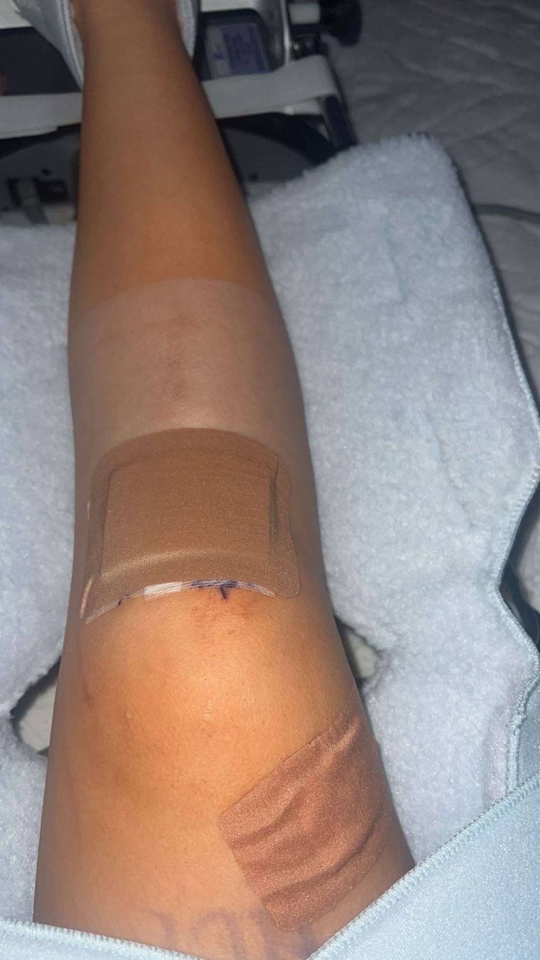 Natalie Silva is still recovering from a torn anterior cruciate ligament injury in her right knee that she says happened in February 2024 during a high school soccer game played on a turf field.