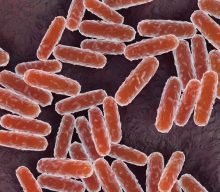What to know about pneumonic plague after woman in Russia dies from mysterious illness