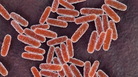 What to know about pneumonic plague after woman in Russia dies from mysterious illness